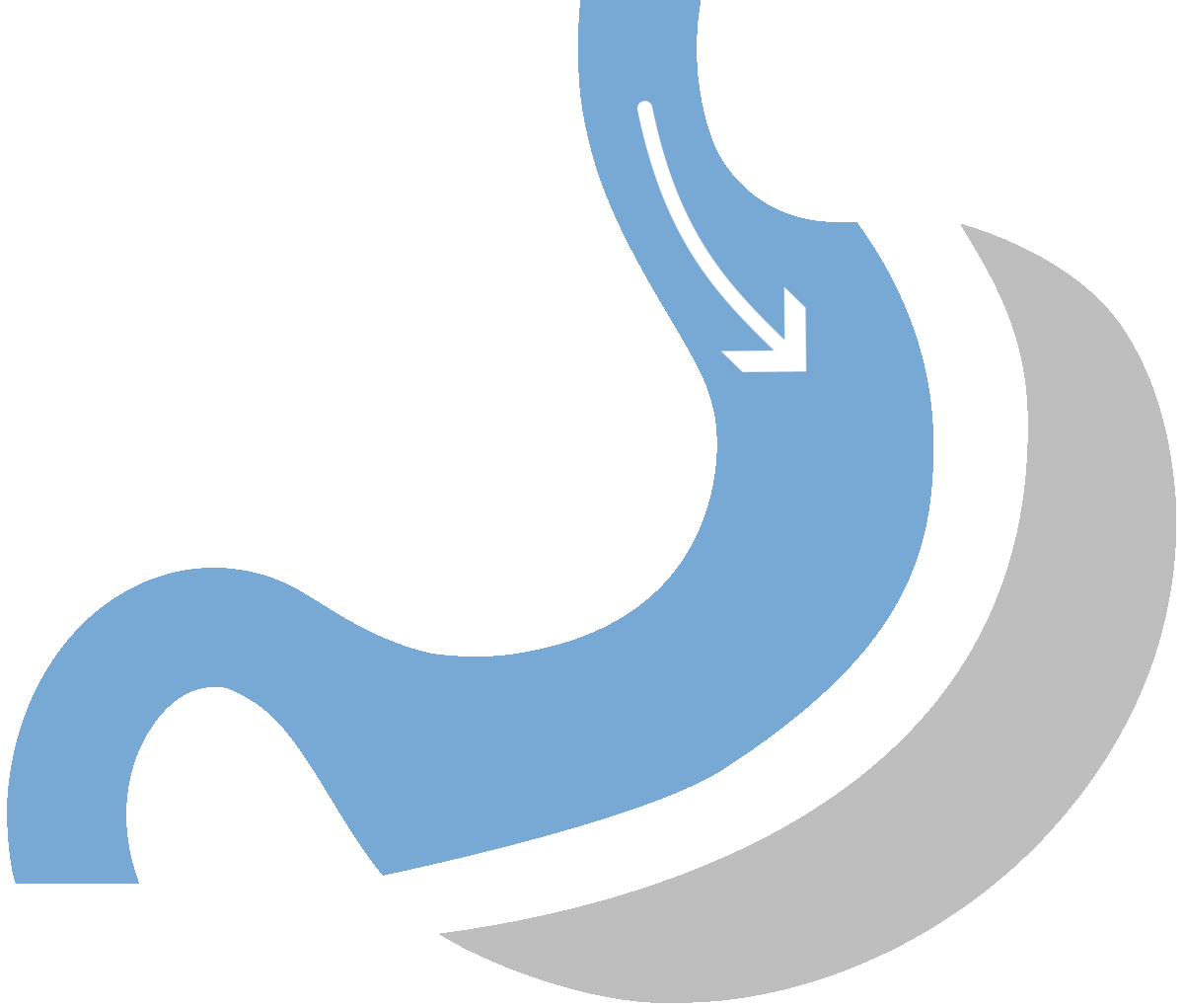 DUODENAL SWITCH