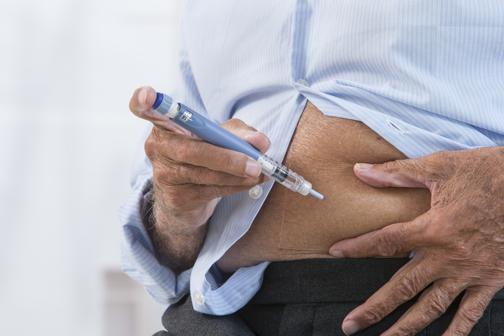 Duodenal Switch