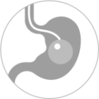 endoscopy-gastric-balloon-edited-150x150